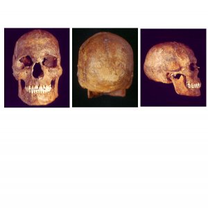 Il cranio dell'individuo Romito 7